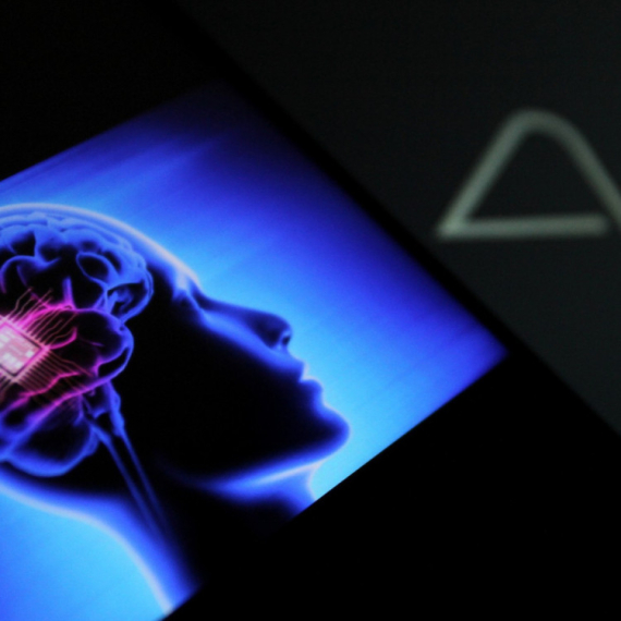 Kvar na Neuralink čipu u mozgu: Maskova firma htela da ga ukloni