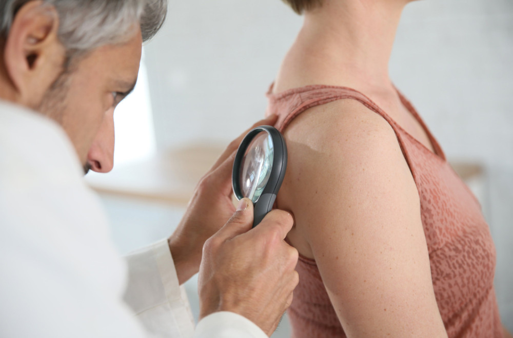 Zašto je važan preventivni dermatološki pregled? VIDEO