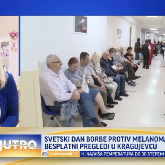 Svetski dan borbe protiv melanoma: Besplatni pregledi u Kragujevcu VIDEO