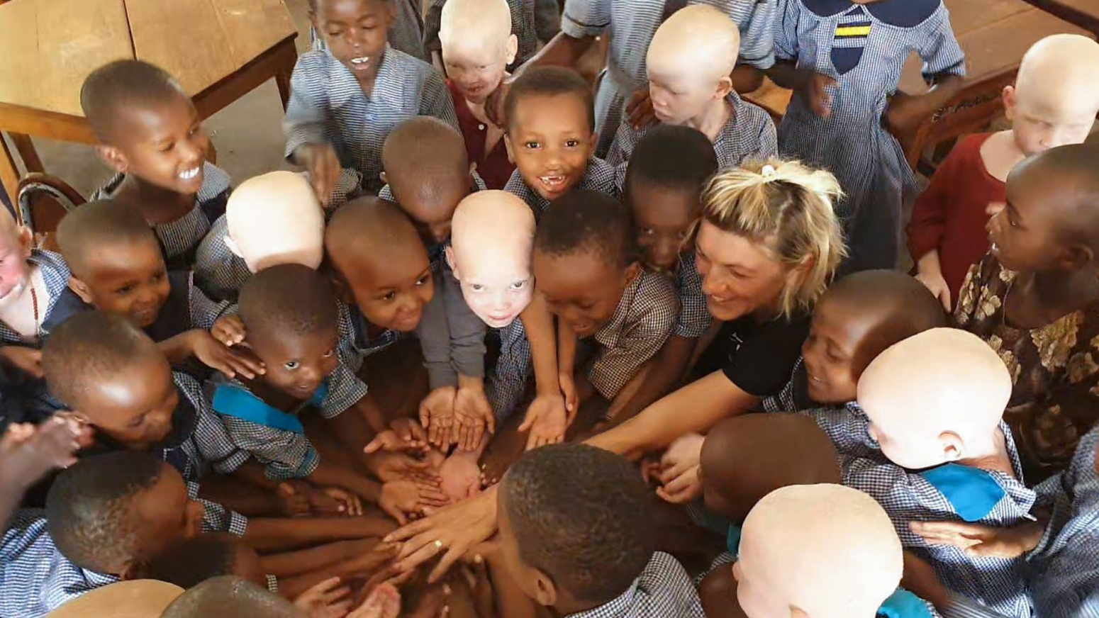 Martina spašava decu sa albinizmom: „Ispod kože smo svi jednaki”