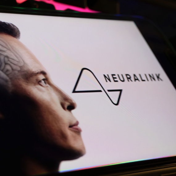 Nastavlja se: Neuralink čip u mozgu drugog pacijenta