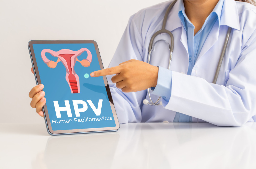 Kako izbaciti HPV virus iz organizma