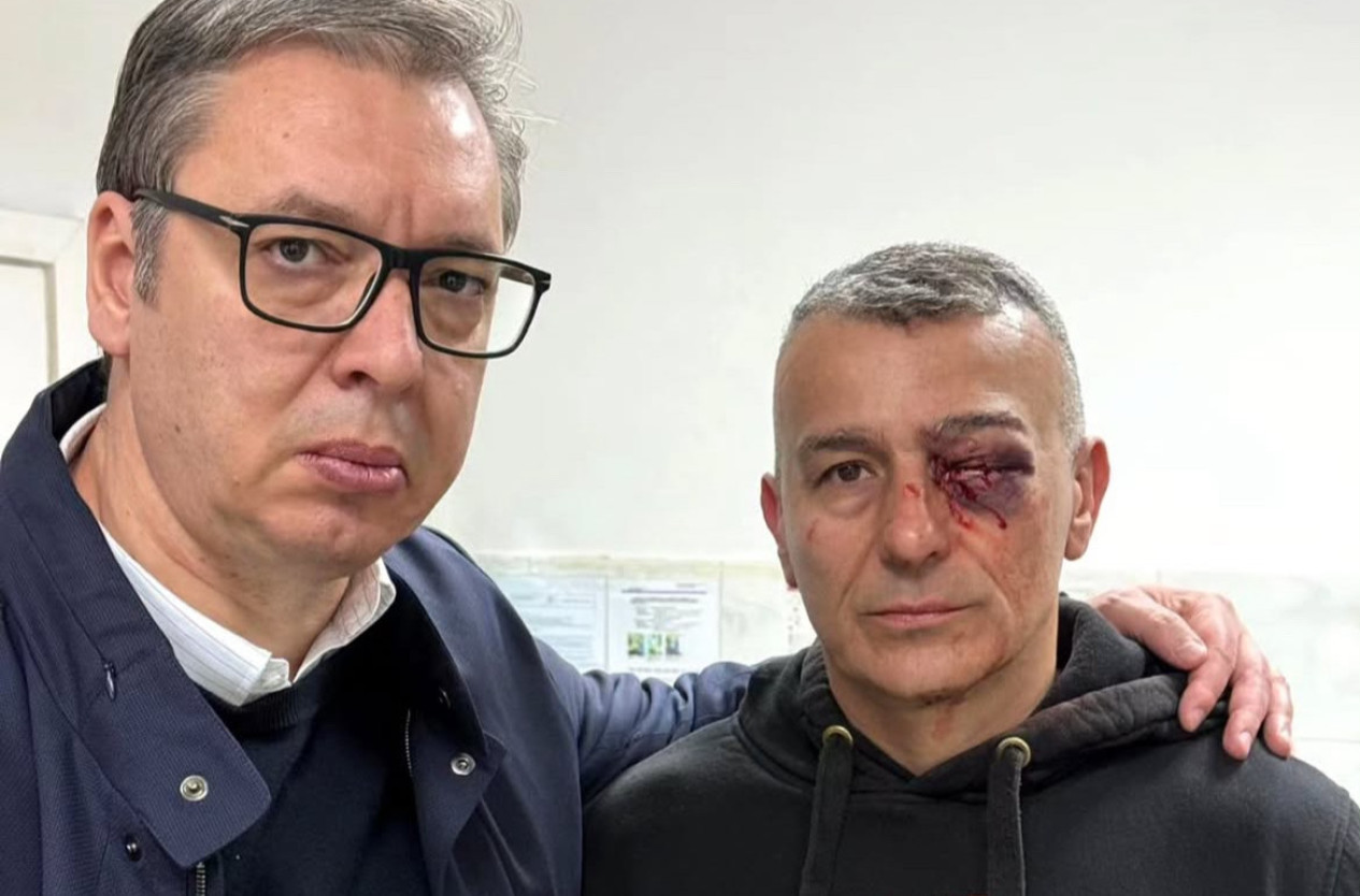 Vučić o napadu na policajca: Jezivo je povređen, ima teške telesne povrede FOTO