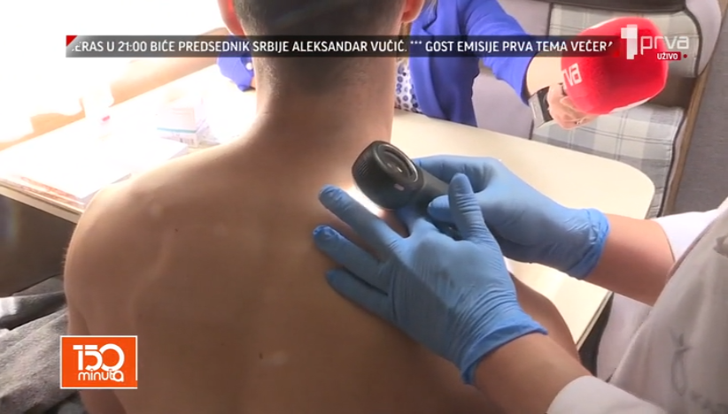 Preventivni dermatološki pregledi u 12 gradova u Srbiji