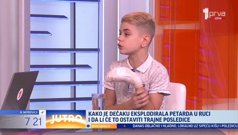 Zbog petarde ostao bez dva prsta