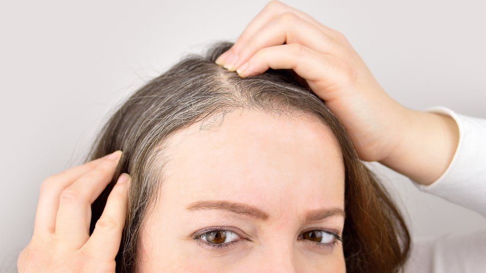 Zdravlje, stres i nauka: Nauènici otkrili zašto kosa osedi