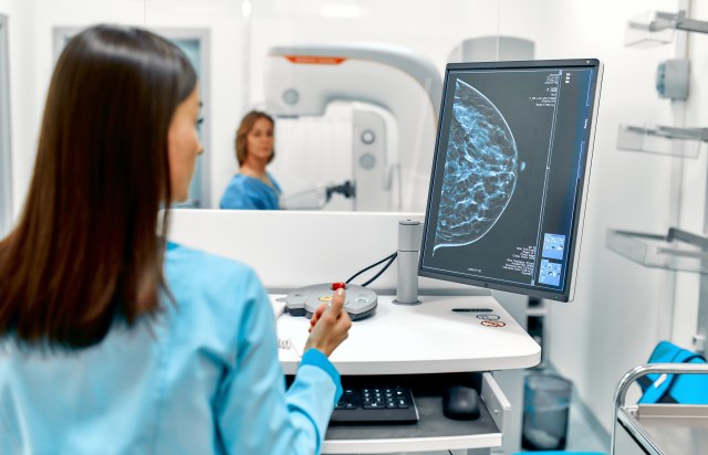 Počeo sa radom digitalni mamograf: Pregledane prve Leskovčanke