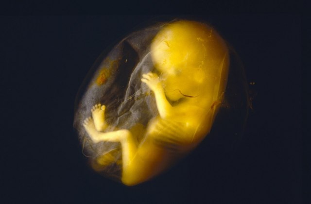 Novi navodi o pronađenom fetusu 